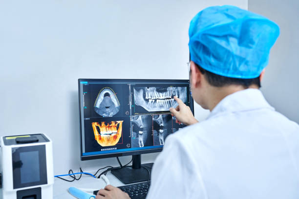 Best Emergency Wisdom Teeth Removal in Jonesboro, GA
