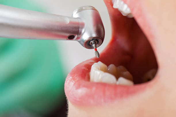 Best Walk-In Emergency Dentist in Jonesboro, GA